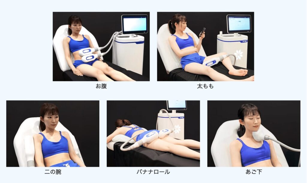 脂肪冷却(クールスカルプティング)は効果ないの?